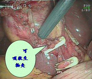 image004.gif
